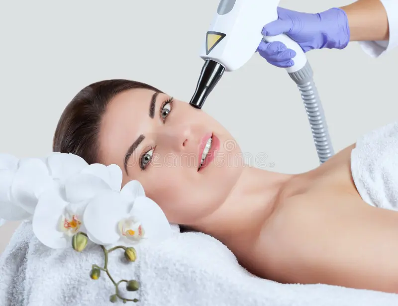 Carbon Peel Laser